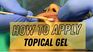 How to Apply Topical Gel on our Patient [upl. by Lahcsap134]