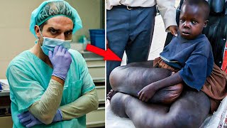 When Doctors took a look at this Elephant Boy They were Shocked by what They Saw [upl. by Enerol]