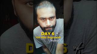 Day 6 100 DAY HAIR REGROWTH challenge ytshorts [upl. by Alicia]