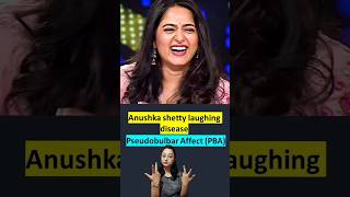 Laughing Disease  Pseudobulbar affect  ye kya hai [upl. by Jauch739]