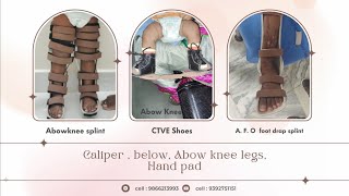 Above Knee Caliper [upl. by Eidak]