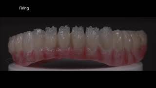 All On Six  IPS emax Ceram  Whitepeaks Dental Solutions  Zirconium emax ceram build up Cutback [upl. by Llehctim]