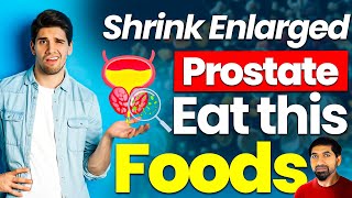 Foods To Eat With Enlarged Prostate  Best Foods For Prostate [upl. by Amand]