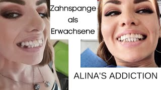 Zahnspange als Erwachsene [upl. by Anelac]