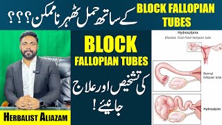 Fallopian Tubes Blockage  Causes amp Symptoms  Get Pregnant With Blocked Tubes  EhtishamJanjua [upl. by Aneehs529]