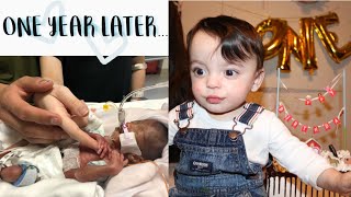 BORN AT 23 WEEKS OLD MICRO PREEMIE 1 YEAR UPDATE  Noah’s Journey [upl. by Nickolaus]