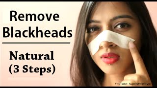 How to Remove Blackheads From Nose amp Face  Naturally at Home  Superwowstyle [upl. by Epotimet103]