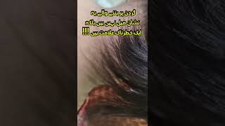 Whats Behind the Black Neck Acanthosis Nigricans Causes Symptoms amp Cure [upl. by Annekam]