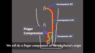 How an incompetent LSV becomes competent instantly [upl. by Akimert]