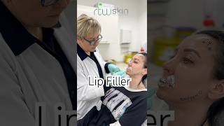 Lip Filler 💋 kentclinic [upl. by Nylcsoj]