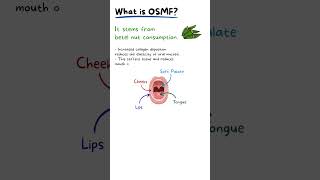 Oral Submucosis Fibrosis Explained [upl. by Ennovaj633]