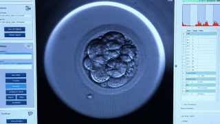 Embryoscope™  CREATE Fertility [upl. by Vladimar]