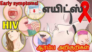 AIDS symptoms in TamilAIDS in Tamilhiv explained in tamilaids explained tamilhiv symptoms tamil [upl. by Bathsheba]