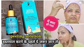 How to Use pilgrim peeling solution Pigmentation amp Acne ScarsAll about chemical Exfoliation [upl. by Abott]