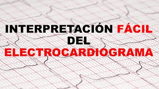 INTERPRETACIÓN FÁCIL DEL ELECTROCARDIOGRAMA 12 DERIVACIONES [upl. by Rodoeht]