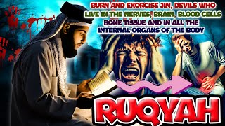 PLAY NOW❗ RUQYAH DESTROYS JIN SATAN MAGIC IN THE BODY amp HEAD [upl. by Eem]