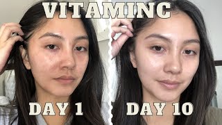 adding VITAMIN C serum to my skincare routine for 10 days  Vichy LiftActiv before amp after [upl. by Maisie]