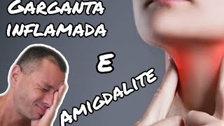 Como CURAR GARGANTA INFLAMADA em 1 DIA Parece Mágica [upl. by Rustie]