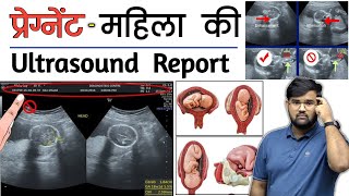 Pregnancy Ultrasound  Ultrasound Report  Medical  Doctor  MBBS  BHMS  BAMS  Nursing [upl. by Adnilemreh252]