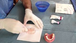 Stabilizing Teeth [upl. by Angus]