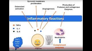 Rheumatoid Arthritis pathology in 5 minutes [upl. by Hesler]