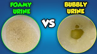 Foamy Urine vs Bubbles in Urine What is the Difference [upl. by Eicam411]