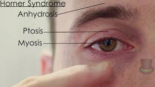 Resp Examination of the Face [upl. by Irok591]