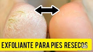 EXFOLIANTE CASERO PARA LOS PIES RESECOS Y AGRIETADOS [upl. by Georgena]