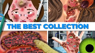 A large gold collection CLEANING ALL BODY SURFACES FROM ACNE AND PARASITES ASMR COLLECTION [upl. by Bruns370]