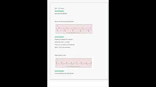 Relias Dysrhythmia Basic A Questions amp Answers All Correct amp Verified [upl. by Ajax]