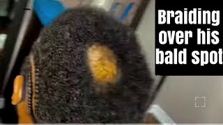 Braiding over his bald spot  very short hair  covering his bald spot  men protective style [upl. by Onimixam]