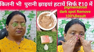 live class 🧿Pigmentation kaise Remove kre 100 Result [upl. by Allyce]