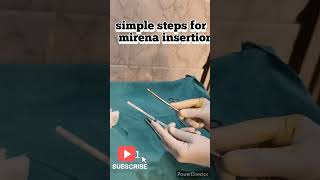 mirena iucdhow to insert mirena hormonal iucdlevonorgestrolendometriosis adenomyosisiucd [upl. by Clava]