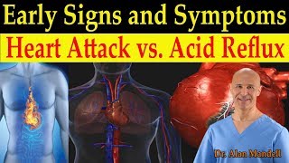 Identifying Heart Attack vs Acid Reflux GERD Early Warning Signs amp Symptoms  Dr Mandell DC [upl. by Annez]