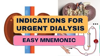 Indications For Urgent Dialysis  Easy Mnemonic [upl. by Will]