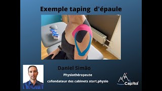 Présentation dun taping de lépaule [upl. by Altis]