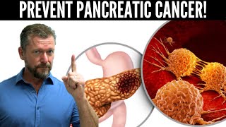 Lower Pancreatic Cancer Risk Pancreas Cancer Risk Test [upl. by Bradan]