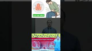 Managing Fissure Surgery Side Effects drimtiazhussain viralshorts [upl. by Suiddaht]