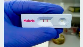 How To Use Malaria Rapid Diagnostic Test  Step by Step [upl. by Latsyrcal196]