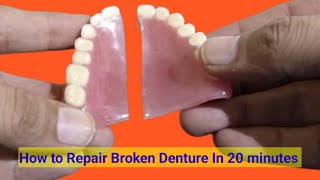 Broken Denture Repair in 20 minutes How to Repair Broken Denture In 20 minutes By Haiderdentures [upl. by Jordans]