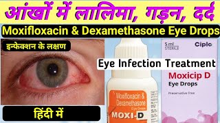 moxi d eye drops hindi  moxifloxacin and dexamethasone eye drops  moxicip eye drops in hindi [upl. by Winshell]