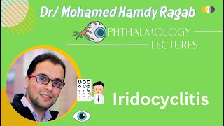 Uvea 2 Iridocyclitis [upl. by Akalam]