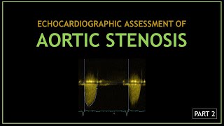 AORTIC STENOSIS Echocardiographic assessment  PART 2 [upl. by Gayle]