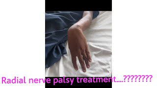 radial nerve palsy  wrist drop treatment  tendon transfer surgery for radial nerve palsy [upl. by Barnabe]