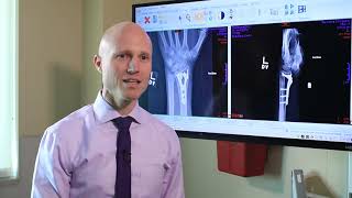 Broken Wrists Fracture Types Treatment Options amp Recovery  Dr Froelich [upl. by Atreb]