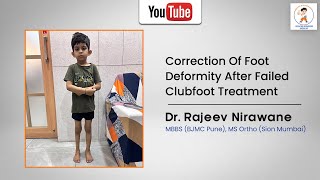 Correction Of Foot Deformity After Failed Clubfoot Treatment by Dr Rajeev Nirawane [upl. by Anwahsar292]