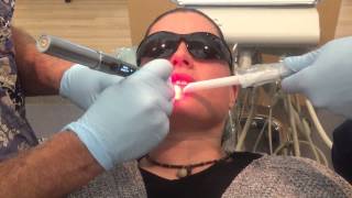 Cold Sore Laser Treatment by Flagstaff Dentist John L Bacon DDS [upl. by Asiulairam]