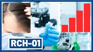 RCH01  Replicels new 2020 Hair Loss Treatment [upl. by Livvi]