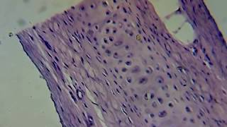 Hyaline Cartilage Section Under the microscope [upl. by Heiney]