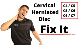 Cervical herniated disc exercises [upl. by Inavoy]